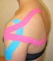 Medical taping, oftewel medisch tapen met Cure Tape